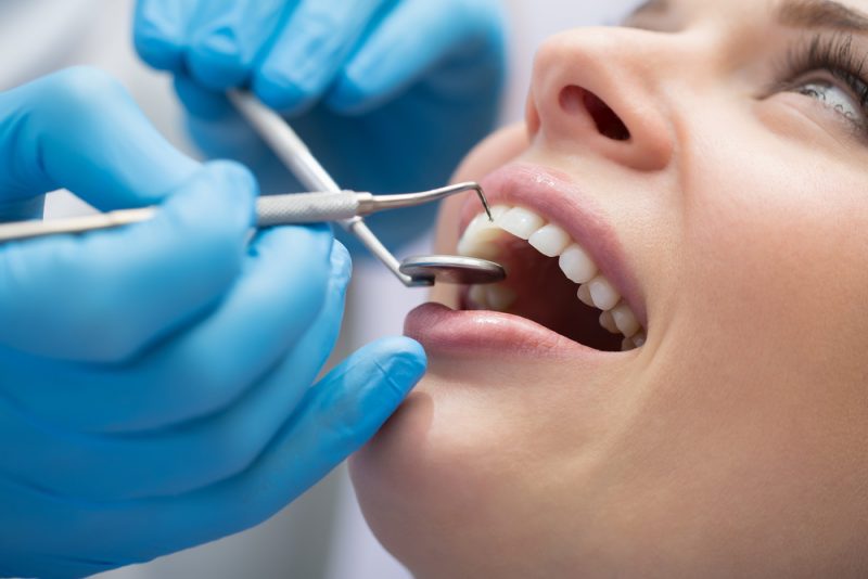 רופאי שיניים בכפר סבא. תמונה ממאגר Shutterstock- By bezikus